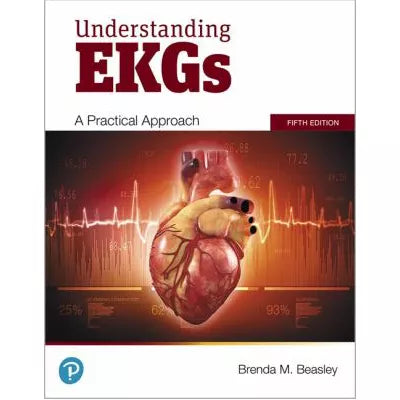 Understanding EKGs