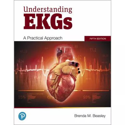 Understanding EKGs : A Practical Approach