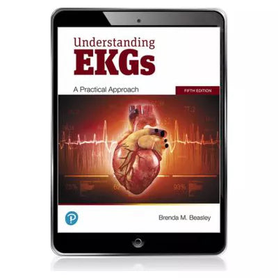 Understanding EKGs